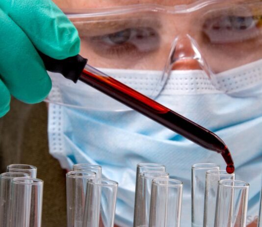 Как пройти коагулограмму: что должны знать жители Харькова?